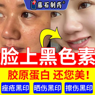 藤石制藥炎癥后臉上黑斑點(diǎn)黑色素可搭去除臉部排毒排黑色素黑色素沉淀面部去斑去黑色素臉部醫用色素下暗沉膏使用N3 一盒 白愈康膏 送棉簽【臉上黑色素】建議療程使用