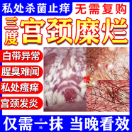 [金婦康]消糜栓 3g*7枚 1盒裝 婦科炎癥霉菌性陰道炎宮頸糜爛專用藥陰道炎婦科炎癥用藥陰道塞藥外陰瘙癢專用消炎藥 一盒10枚克霉唑 婦科專用