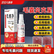【】北密阿米毛凈康 60ml/瓶 買二宋一 發(fā)三瓶