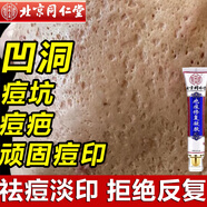 同仁堂祛痘印修復淡化痘印痘坑修復凹洞去痘坑去痘疤去痘痘和痘印粉刺 一盒裝【拍二發(fā)三】