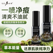 馬氏本草祛痘精華噴霧控油修復保濕液淡化痘印去痘痘男女士面部精華水 祛痘修護精華噴霧20ml