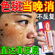 東來美美白祛斑霜專用醫(yī)用正品的藥淡化黑色素去臉部雀斑手背黃褐老年斑 買五送四【不再范】 20g