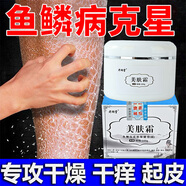 老湖堂魚鱗皮膚霜滋潤保濕病護膚小腿蛇皮膚紋路雞皮膚防干燥脫皮身體乳 買3發(fā)5【光滑肌膚 拒絕反復(fù)】 選擇套餐