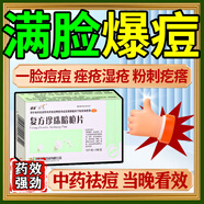 祛痘去痘痘消炎痤瘡專用閉口粉刺復(fù)方珍珠暗瘡片青春痘祛痘痤瘡專用藥臉上去痘痘的藥清熱解毒下巴紅腫硬痘痘 3盒裝【滿臉青春痘 消炎祛痘】皮膚用藥 非處方藥