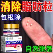 秋雅奈緒脂肪粒去除神器眼周專(zhuān)用去小顆粒顆粒清肌眼霜藥膏醫用精華液軟膏 一盒裝【推薦買(mǎi)二送一療程使用】 脂肪粒汗管瘤進(jìn)口克星