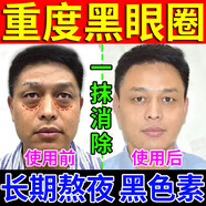 國醫制藥眼袋霜去眼袋消除重度眼袋貼專(zhuān)用嚴重中老年男士女士眼袋去除神器 二盒 專(zhuān)研黑眼圈【去除眼周沉淀黑色素】