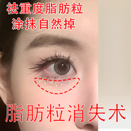 脂肪粒去除藥膏神器眼部專(zhuān)用眼霜消除汗管瘤脂肪油脂克星 買(mǎi)五送五【告別脂肪?！?
                                         title=