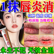 杏元郞唇炎專(zhuān)用醫用級唇炎膏兒童慢性嘴唇干裂口角炎脫皮口唇炎反復開(kāi)裂 買(mǎi)3贈2【告別唇炎】永久不犯 上火起泡爛嘴凝膠修復保濕