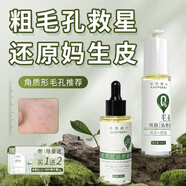 依思佩爾（EASPEER）【官方直營(yíng)】煥膚清理液溫和祛舊角質(zhì)護理改善毛孔粗糙控油溫和不 80ml角質(zhì)形毛孔套裝 油性及混合偏油膚質(zhì)