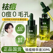馥珮祛痘精華水30ml楊酸去痘舒緩精華液青春痘痕青少年淡化改善痘肌
