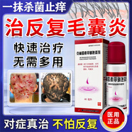 天龍毛囊炎頭部專用藥頭皮癢止癢頭皮起膿包疙瘩藥膏真菌感染脂溢性皮炎皮膚用藥【視覺特效】克林霉素甲硝唑搽劑 1盒裝【毛囊炎專用】