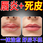伊思韓嘴唇防干裂脫皮修護嘴角開(kāi)裂潤唇膏補水保濕滋潤唇炎膏 涂完就見(jiàn)效