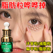 柏妮西亞（Bonixiya）脂肪粒去除藥膏汗管瘤脂肪粒去除神器眼周專(zhuān)用去小顆粒眼霜精華素 買(mǎi)三送二【五盒裝】鞏固裝