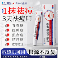 久卜制藥祛痘藥膏青春痘祛痘淡化痘印痘坑消炎痤瘡粉刺專(zhuān)用學(xué)生青少年 1盒