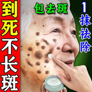 巖井昃弘日本進(jìn)口祛斑霜祛斑黃褐斑雀斑曬斑女男士用的老人斑專(zhuān)用去黑色素 特效：買(mǎi)3發(fā)5【終身無(wú)斑點(diǎn)】醫用正品 效果最好的產(chǎn)品臉部手背美白淡化非中藥一夜消