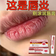 伊思韓香港中西大藥房唇炎膏防干裂保濕補水口角干裂去死皮起皮修復唇膏 涂完就見(jiàn)效