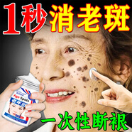 萊覽奧蓋祛斑霜美白淡化老年黃褐雀斑黑色素曬斑去祛斑男女士專(zhuān)用醫用正品 特效;買(mǎi)3送2【大面積斑點(diǎn)選擇】 老人斑臉部手背效果最好的產(chǎn)品非中藥水一夜消