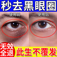 北京同仁堂眼霜淡化細紋提拉緊致黑眼圈重度去除祛男女士熬夜黑色素專(zhuān)用的藥 買(mǎi)3送2【發(fā)5盒】100%有效