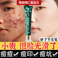 百幽草南京同仁堂水楊酸祛痘膏面霜淡化痘印痘疤痘坑男女士學(xué)生 一瓶裝【按療程使用效果更佳】