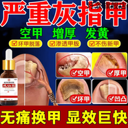 正元匠套盒亮甲手腳專(zhuān)用甲板增厚修復灰指甲壞甲發(fā)黃變厚  護理身 3盒35個(gè)趾甲問(wèn)題