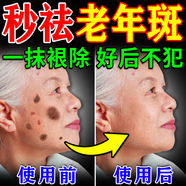 碧素堂祛斑霜老年斑專(zhuān)用特效非藥一夜消強力祛除手部臉部男女祛斑專(zhuān)用霜 一盒裝 祛斑效果最好的產(chǎn)品