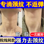 [臣功]維A酸乳膏 15克/支 2盒裝 維A酸乳膏脖子去頸紋去除神器淡化頸紋去頸紋頸霜膏頸部去頸紋膏去提拉緊致祛斑祛皺紋 脖子長(cháng)滿(mǎn)紋 一抹驗效