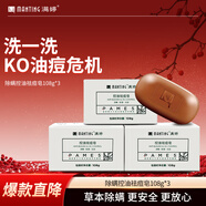 滿(mǎn)婷（MANTING）清螨控油祛痘皂108g*3塊(除螨蟲(chóng)香皂螨婷肥皂潔面皂沐浴露非硫磺)