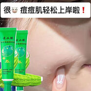 露蘭姬娜（ROLANJONA）金蘆薈痘膠膏消痘去粉刺青春痘男女學(xué)生祛痘收縮毛孔面霜正品 老牌祛痘膏二盒+粉刺針 60g 20年老牌子丨80丨90丨00后都用過(guò)