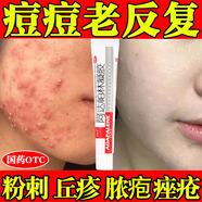 [花容美]阿達帕林凝膠 祛痘淡化痘印醫用祛痘消炎痤瘡專(zhuān)用青少年祛痘藥膏祛痘消炎痤瘡專(zhuān)用皮膚用藥 0.1%*10g 1盒裝 【臉上起粉刺】