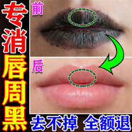 今古透嘴唇黑色素去除唇周暗沉神器烏唇嘴角發(fā)黑保濕滋潤嘴唇防干裂脫皮 買(mǎi)1發(fā)3【告別唇周黑】快速見(jiàn)效
