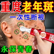 北京協(xié)和醫學(xué)院祛斑霜老年斑專(zhuān)用特效非藥一夜消去老年斑的藥強力祛除手部臉部 9盒【永保青春】買(mǎi)5送4祛斑專(zhuān)用醫用正品 美i白祛斑霜淡化黑色素黃褐斑雀斑曬斑男女士專(zhuān)用的