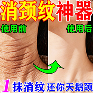 [信龍]水楊酸軟膏 5%*20g 1盒裝 頸紋去除神器脖子去頸紋神器淡化頸紋頸紋醫用藥膏去頸紋藥霜膏淡化頸紋提拉緊致非貼 頸紋醫用藥膏法令紋專(zhuān)消