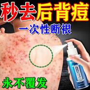 北京同仁堂后背痘痘藥膏后背長(cháng)痘痘毛囊炎專(zhuān)用前胸后背部膿包痤瘡祛痘噴霧劑 買(mǎi)3送2【發(fā)5盒】發(fā)貨特效快