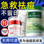 BEAI祛痘膏水楊酸修護淡化痘痘青少年坑印學(xué)生青春痘蘆薈凝膠潔面套裝