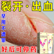 [福元]尿素維E乳膏 15%*50g 5盒裝 手裂口干裂嚴重膏皸裂膏膏手足皮膚干燥手指開(kāi)裂霜醫用2050%（視覺(jué)特效） 換季反復開(kāi)裂脫皮疼痛