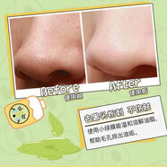 京營(yíng)甄選青少年兒童中學(xué)生除黑頭泥膜收縮毛孔去粉刺黑鼻頭9-12歲女孩鼻膜 默認香型規格 40g 無(wú)效全額退款不用退貨