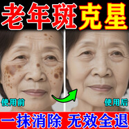 巖井昃弘去老年斑的藥強力祛除手部臉部特效非藥專(zhuān)用點(diǎn)祛斑霜一夜消美白 特效1盒膏【祛斑霜】多買(mǎi)多送 日本進(jìn)口醫用淡化黑色素黃褐雀曬斑男女士美容院專(zhuān)用的