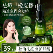 植祛小綠瓶祛痘修護精華液植物精粹學(xué)生青春痘溫和祛痘閉口粉刺男女 2瓶祛痘修護精華液【96%用戶(hù)選擇】