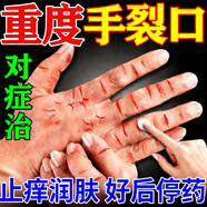 [福元]尿素維E乳膏 15%*50g 5盒裝 手足皸裂膏手裂愈合膏手裂口干裂嚴重皸裂膏開(kāi)裂專(zhuān)用手足皮膚干燥皸裂【視覺(jué)特效】 換季反復手腳干裂