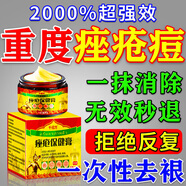 洛神醫痤瘡專(zhuān)用膏特效去青春痘粉刺硬疙瘩青少年祛痘消i炎玫瑰痤瘡專(zhuān)用 泰國升級款：一盒裝 祛痘膏祛痘印淡化青春痘去痘膏專(zhuān)用學(xué)生