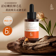臻羞杏仁酸祛痘嫩膚精華液收縮毛孔去黑頭粉刺淡化痘印痘坑靚麗肌膚 【杏仁酸祛痘嫩膚精華液】1瓶