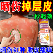 香草雨露日光性皮炎曬傷修復紫外線(xiàn)過(guò)敏專(zhuān)用曬后屏障受損泛紅光性止癢藥膏 買(mǎi)三贈二【曬傷美白】修復霜