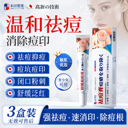 本田制藥日本祛痘膏青春痘祛痘淡化痘印痘坑消炎痤瘡粉刺專(zhuān)用青少年3盒