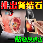 仙人一步腎結石排石藥專(zhuān)用貼日本進(jìn)口100%排石雞內金錢(qián)草溶解化石顆粒雙腎 1盒裝【體驗裝】多買(mǎi)多送