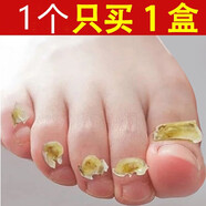 海洋詩韻云南本草灰指甲抑菌液去除變厚發(fā)黃變空腳趾甲本靈灰甲凈非特I效 5盒重度裝【6個(gè)以上問題指甲】
