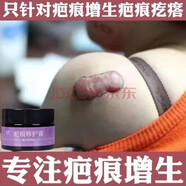 花樂集疤痕膏摔傷抓傷疤體質(zhì)增生凸硬肉疤痕疙瘩胸前修復(fù)去除手術(shù)疤專 單盒裝