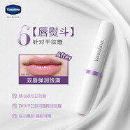 凡士林 潤唇膏 (Vaseline)保濕滋潤精華煥亮鎖水溫和滋養(yǎng)彈潤護唇膏 6號淡紋彈潤1.8g