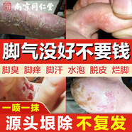 同仁堂腳氣噴劑止癢脫皮腳汗水泡型腳癢腳臭汗噴霧狼毒噴劑60ml+軟膏20g