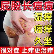懷南堂屁股癢長痘痘久坐濕毒疹坐瘡起疙瘩肛門瘙癢潮濕止癢膏坐板瘡悶頭 買2贈1【屁股疹濕瘙癢克星】