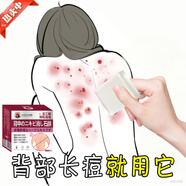 示博士【凈背部痘痘】背粒消前胸后背長痘身體除螨沐浴去痘印美背手工皂 三盒裝【推薦中度螨蟲痘痘】